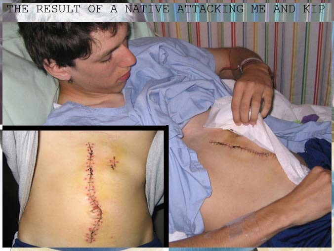 kip_stabbing_staples.jpg
