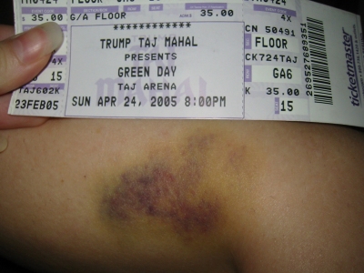 green_day_bruise_03.jpg
