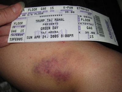 green_day_bruise_02.jpg