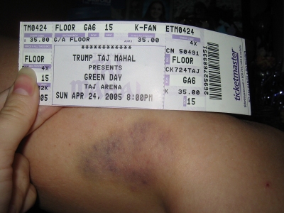 green_day_bruise_01.jpg