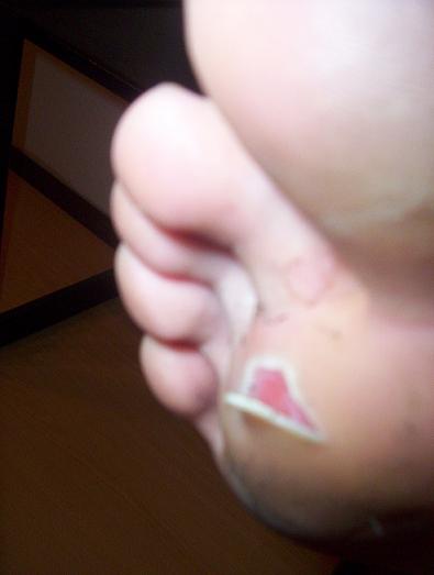 yannic's foot.JPG